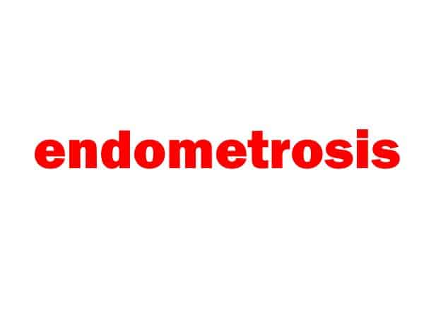 endometrosis. Una enfermedad que no existe