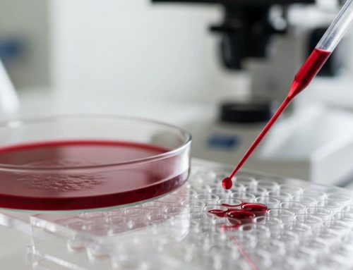 Avance revolucionario: la sangre menstrual acelera el diagnóstico de la endometriosis
